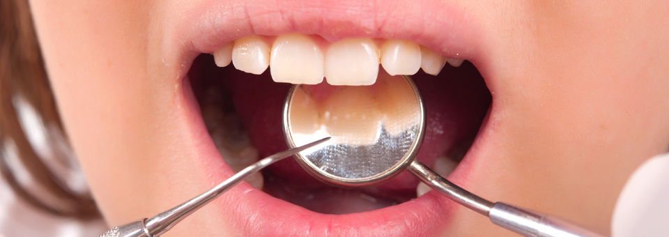 Réparation de prothèse dentaire à Québec | Denturologiste Alain Hamel