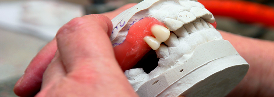 Denturologiste ville de Québec — denturologue Québec Denturologiste ville de Québec — denturologue Québec